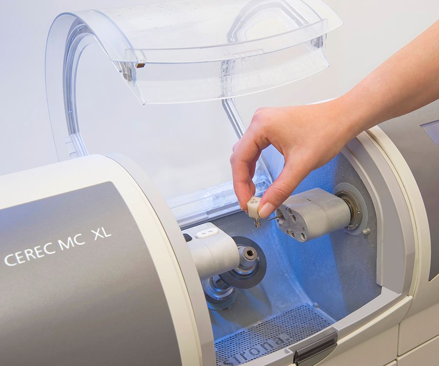CEREC single-visit CAD/CAM restoration